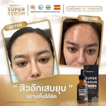 ภาพขนาดย่อของภาพหน้าปกสินค้าของแท้100%พร้อมส่ง เซรั่ม ผิวสวย กระจ่างใส BC Super Serum brownychu super serum เลขที่ใบจดแจ้ง อย :10-1-6400011372 จากร้าน NN Shops 5 บน Lazada ภาพที่ 7