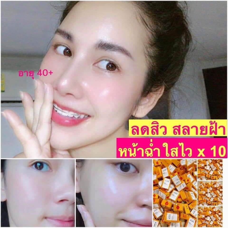 (ส่งฟรีค่ะ)วาวิ้ง วิ้งครีมสูตรคุณหมอขนาด10กรัมหน้าฉ่ำวาวขาวใส