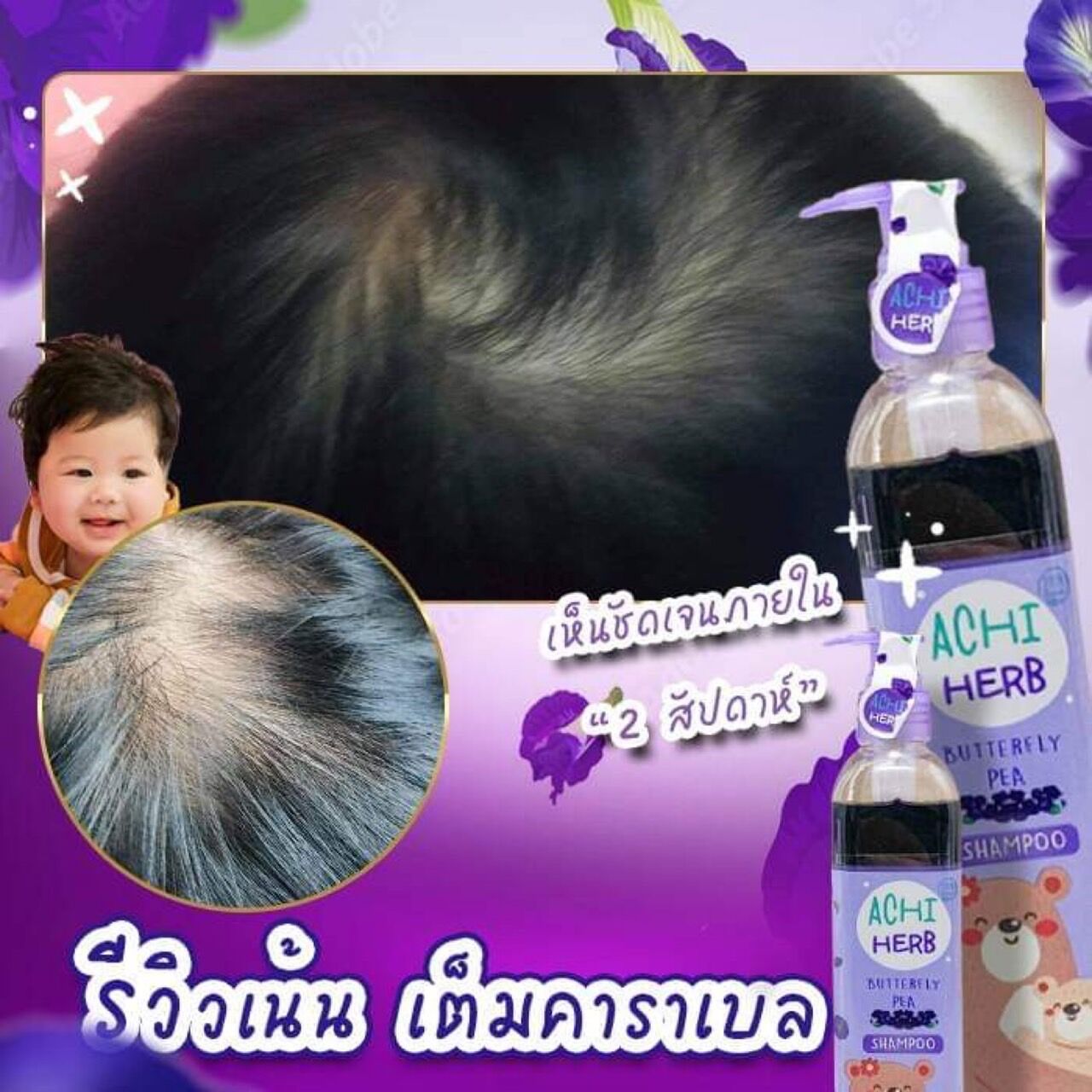 My Image 32