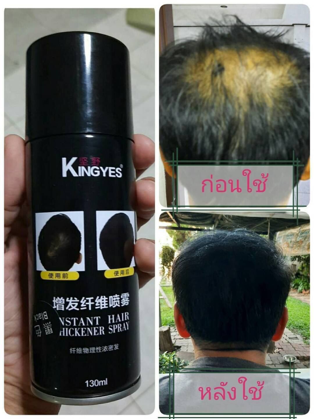 kingyes hair spray สเปรย์ผมไฟเบอร์ ปิดผมบาง แกปัญหาหัวล้าน Lazada.co.th