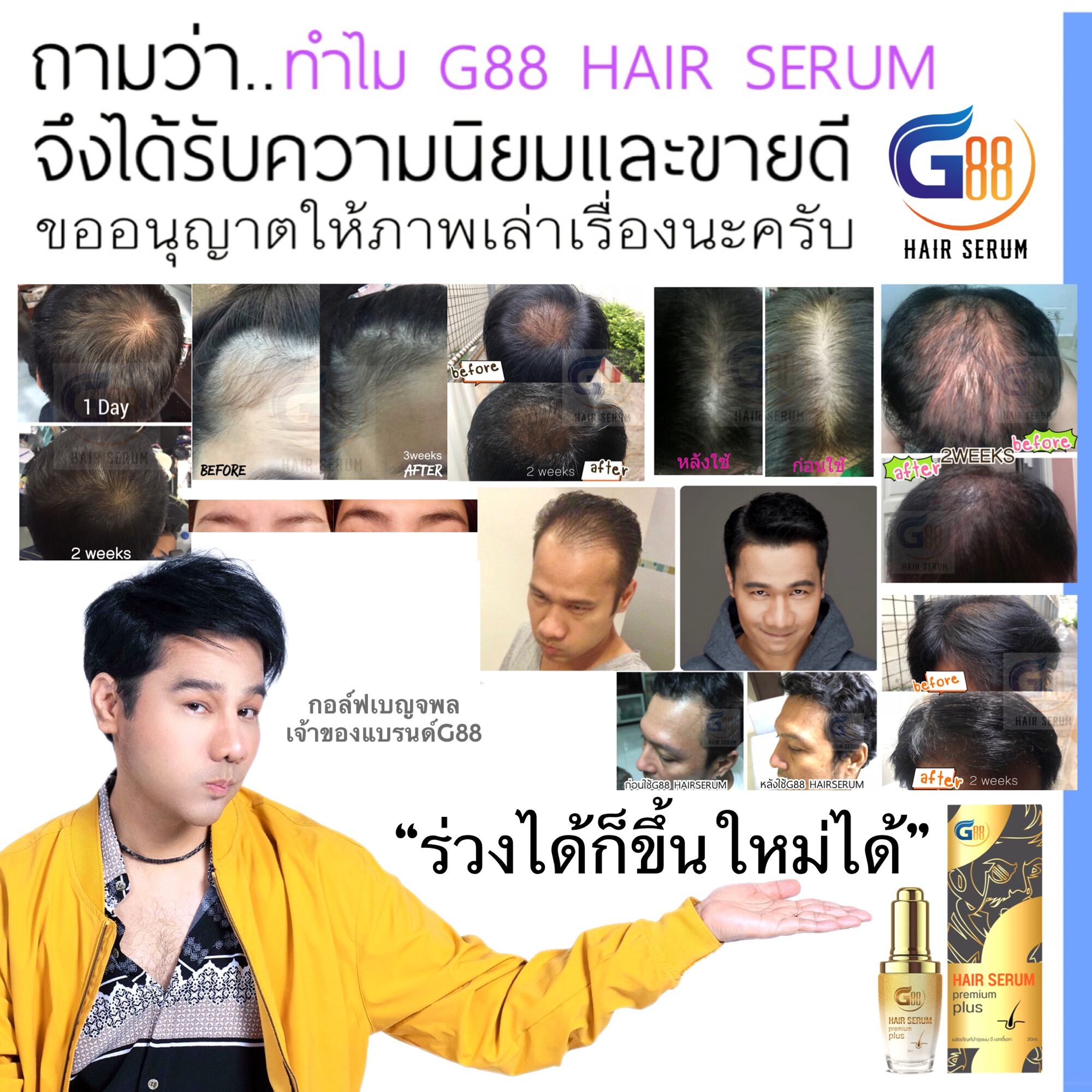 best-set-g88-hair-serum-plus-g88-shampoo-g88