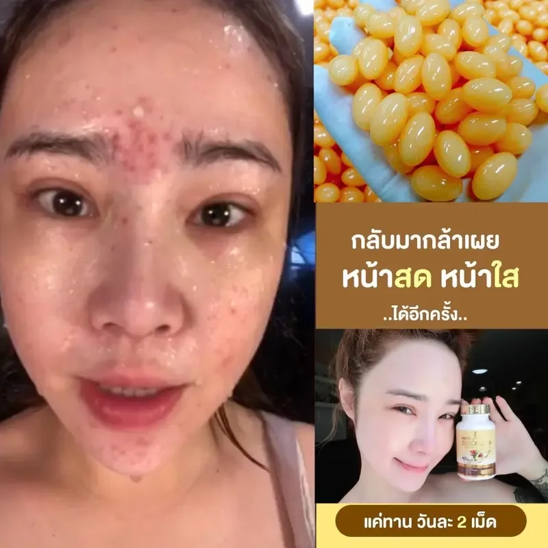 ภาพสินค้าซินคลอต้าของแท้ zincolta น้ำมันอะโวคาโด้สกัดเย็น  Sale 7 วันเท่านั้น จากร้าน Piggyshop64 บน Lazada ภาพที่ 7