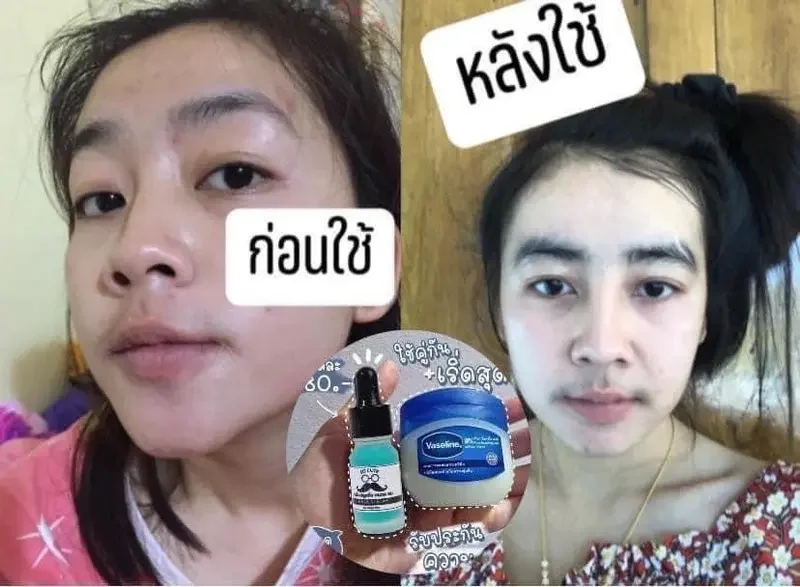 ภาพสินค้าเซรั่มปลูกคิ้ว หนวด ไรผม Cute Serum ขนาด 10 ml. มีบัตรตัวแทน จากร้าน Prakon_shop บน Lazada ภาพที่ 2