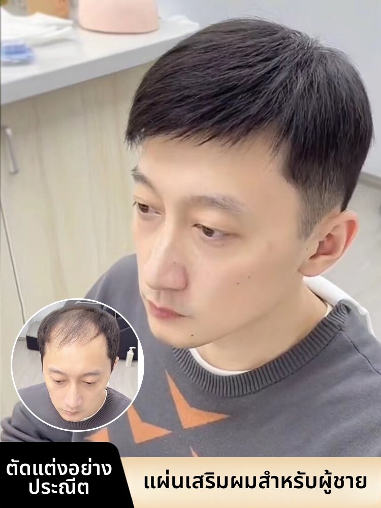 WeiWei | Invisible Thin Short Hair Top Piece Wig for Bald and Grey Coverage ราคา 6,082 บาท*ส่งฟรี