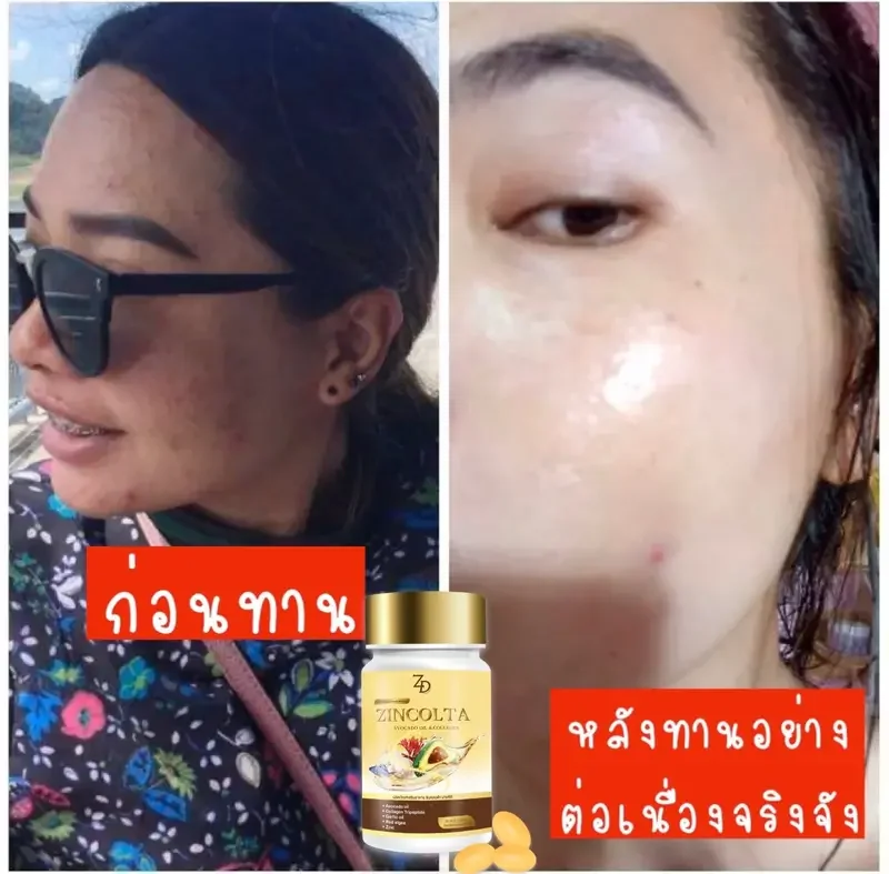 ภาพสินค้าซินคลอต้าของแท้ zincolta น้ำมันอะโวคาโด้สกัดเย็น  Sale 7 วันเท่านั้น จากร้าน Piggyshop64 บน Lazada ภาพที่ 5