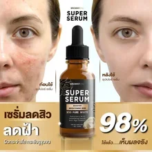 ภาพขนาดย่อของภาพหน้าปกสินค้าของแท้100%พร้อมส่ง เซรั่ม ผิวสวย กระจ่างใส BC Super Serum brownychu super serum เลขที่ใบจดแจ้ง อย :10-1-6400011372 จากร้าน NN Shops 5 บน Lazada