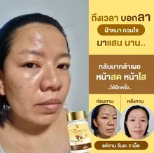 ภาพขนาดย่อของภาพหน้าปกสินค้าซินคลอต้าของแท้ zincolta น้ำมันอะโวคาโด้สกัดเย็น  Sale 7 วันเท่านั้น จากร้าน Piggyshop64 บน Lazada ภาพที่ 6