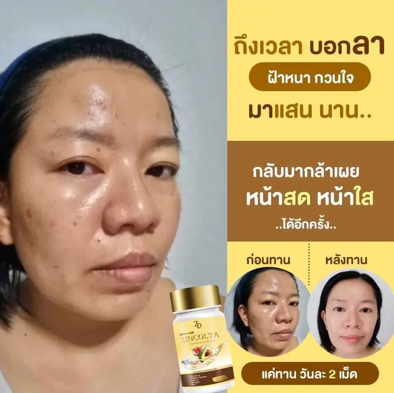 ภาพสินค้าซินคลอต้าของแท้ zincolta น้ำมันอะโวคาโด้สกัดเย็น  Sale 7 วันเท่านั้น จากร้าน Piggyshop64 บน Lazada ภาพที่ 6