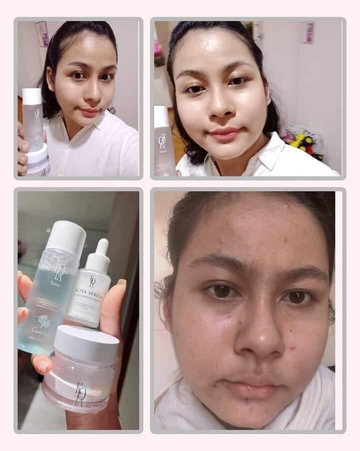 Kota cosmetics and skin care (၃မျိုး) Lazada.co.th
