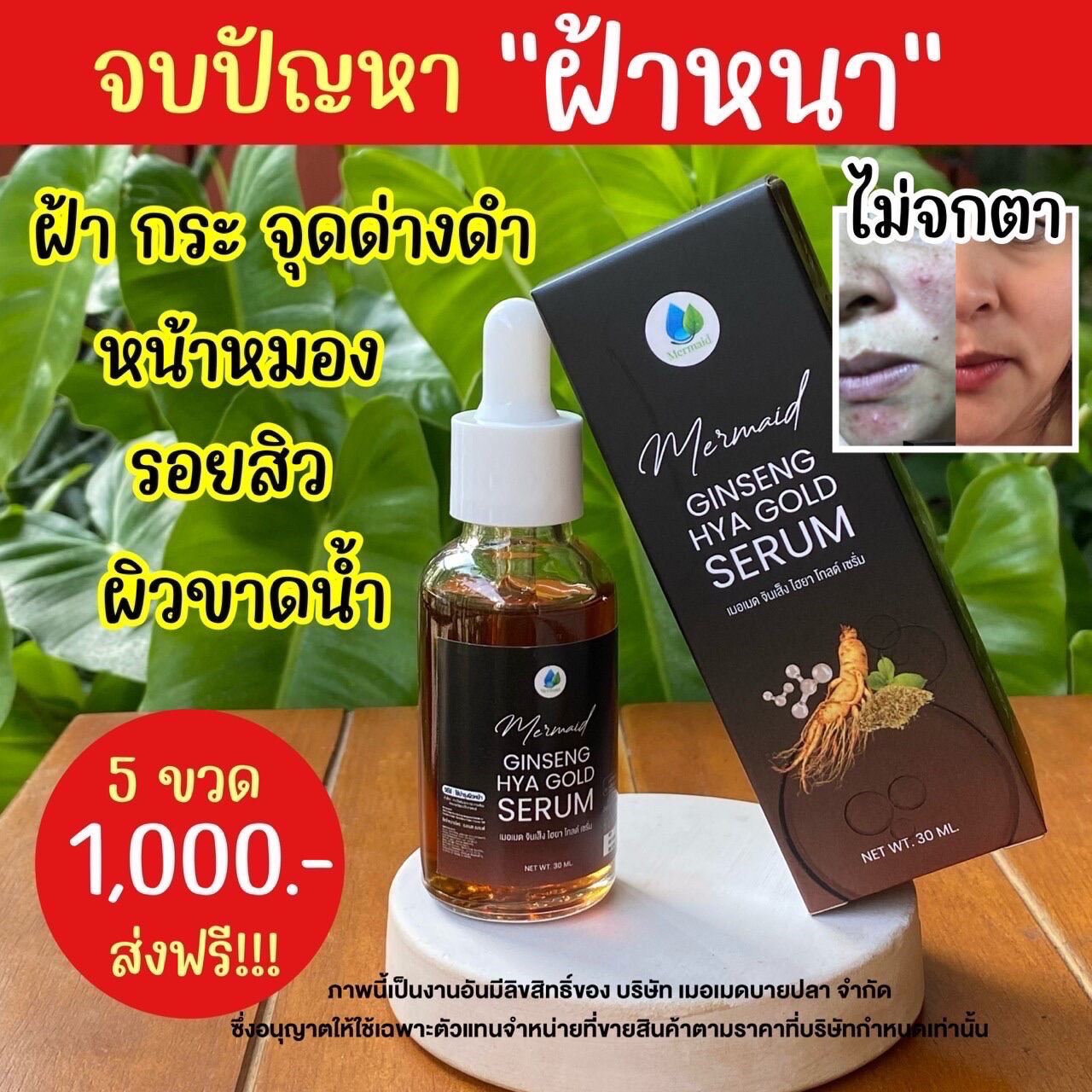 โปร 5 ขวดส่งฟรี ‼️ เซรั่มโสมทอง Mermaid Ginseng Hya Gold Serum สิว ฝ้า 