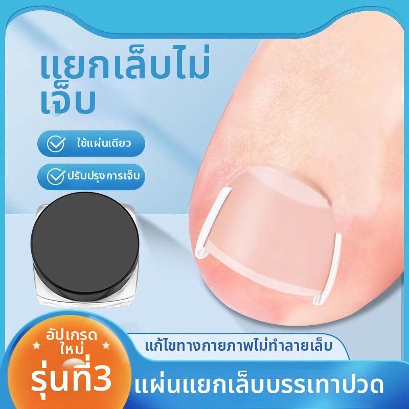 rimei | Ingrown Toenail Correction Tool ราคา 3,974 บาท*ส่งฟรี