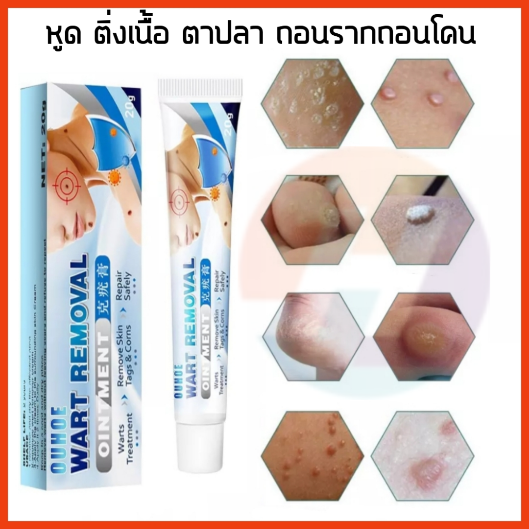 sumifun-warts-remover-cream-herbal-extract-antibacterial-ointment-skin